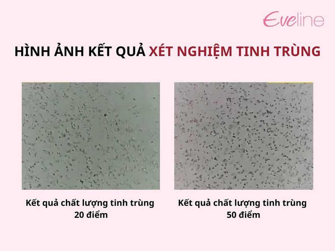 Xét nghiệm tinh trùng là bước quan trọng