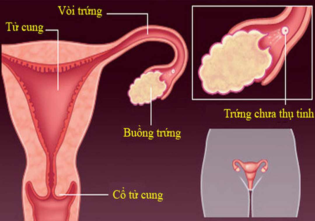 Khi nào cần tránh thai khẩn cấp?