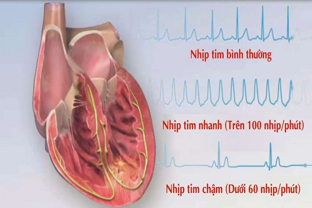 Triệu chứng bệnh ở người lớn