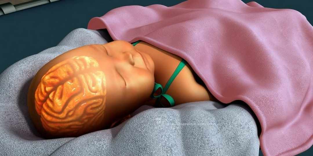 Trẻ sơ sinh sẽ bị vàng da nhân khi chất Bilirubin vượt qua giới hạn cho phép