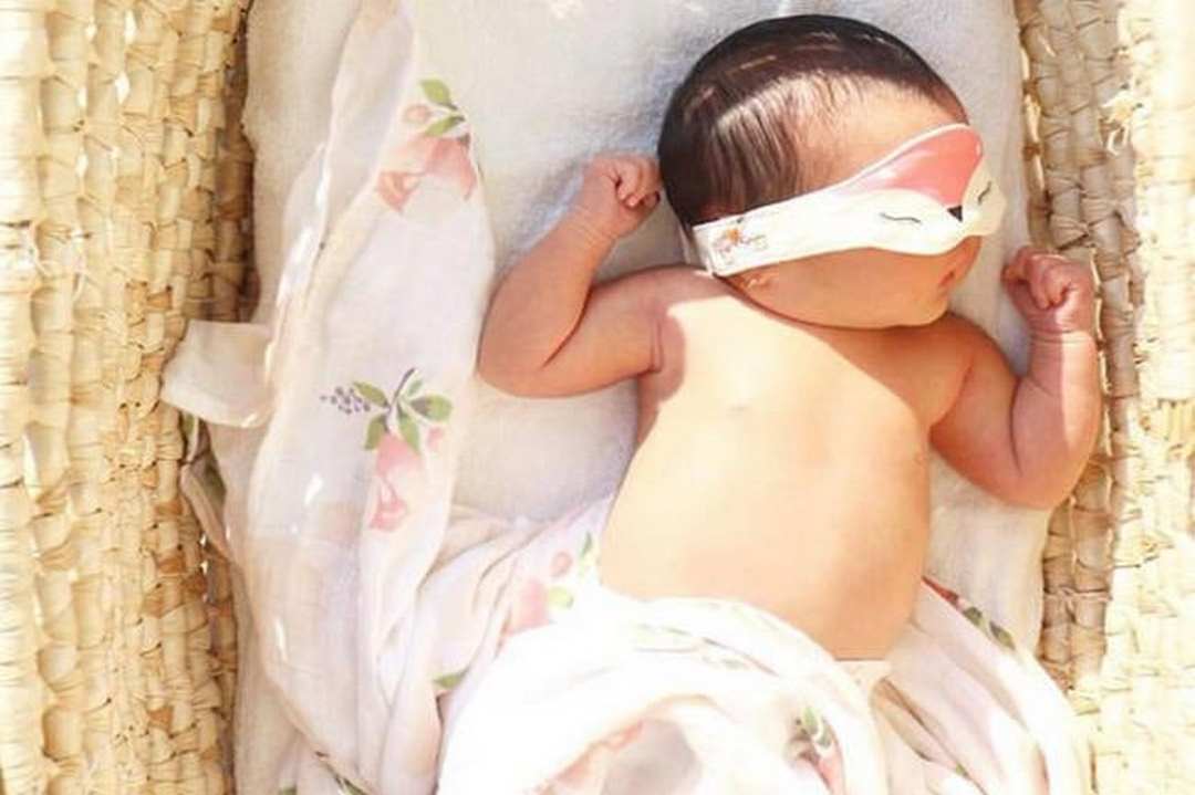 Những lưu ý khi tắm nắng cho trẻ sơ sinh bị vàng da