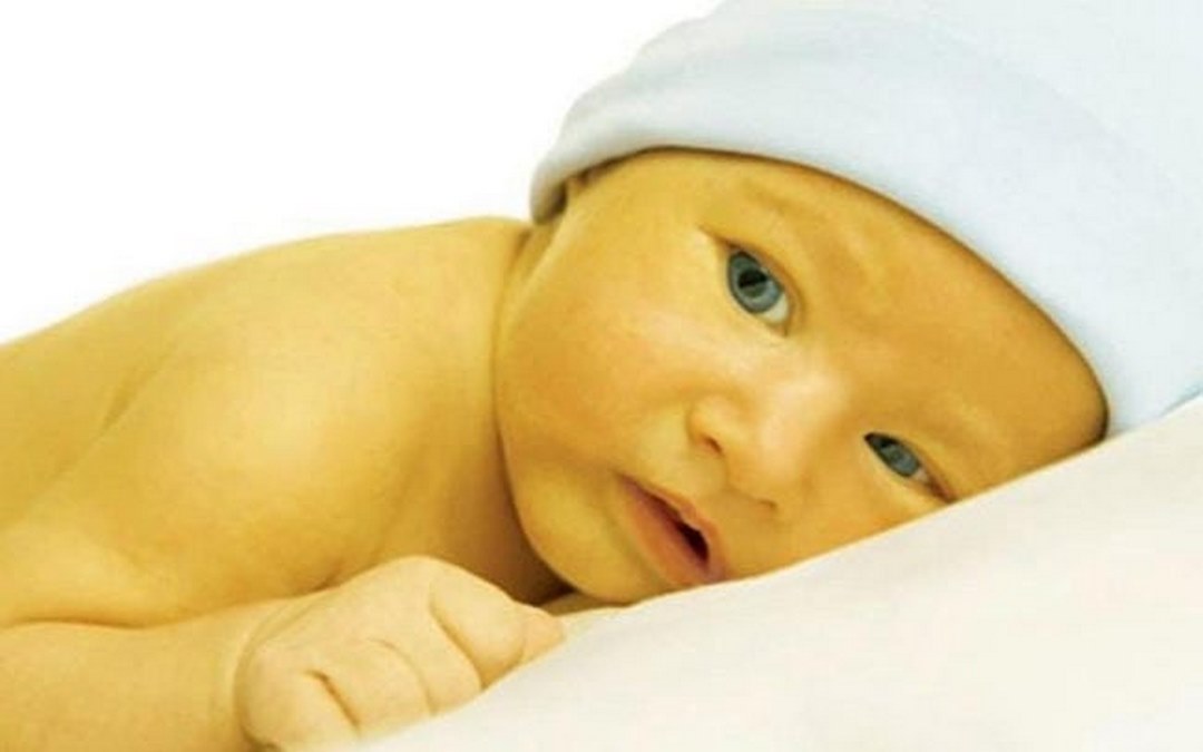Vàng da là bệnh thường gặp ở trẻ thiếu tháng do tăng Bilirubin gián tiếp